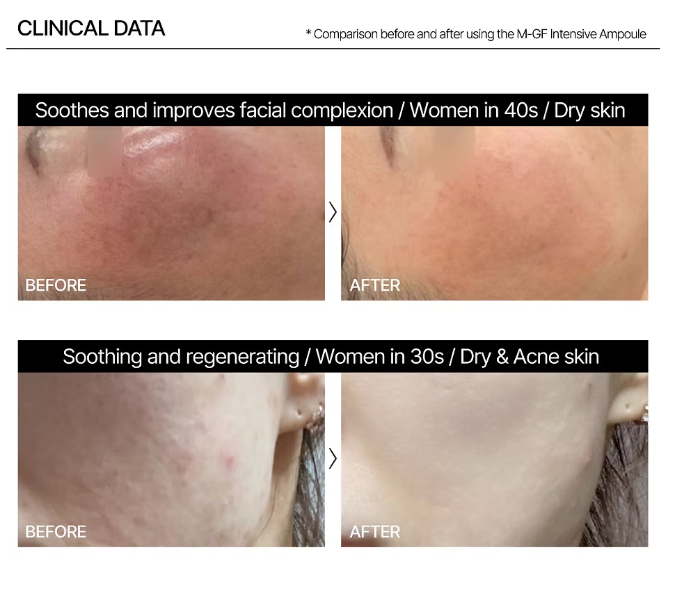 TUPS CURE ANTI AGE SERUM PEPTIDES COREENS